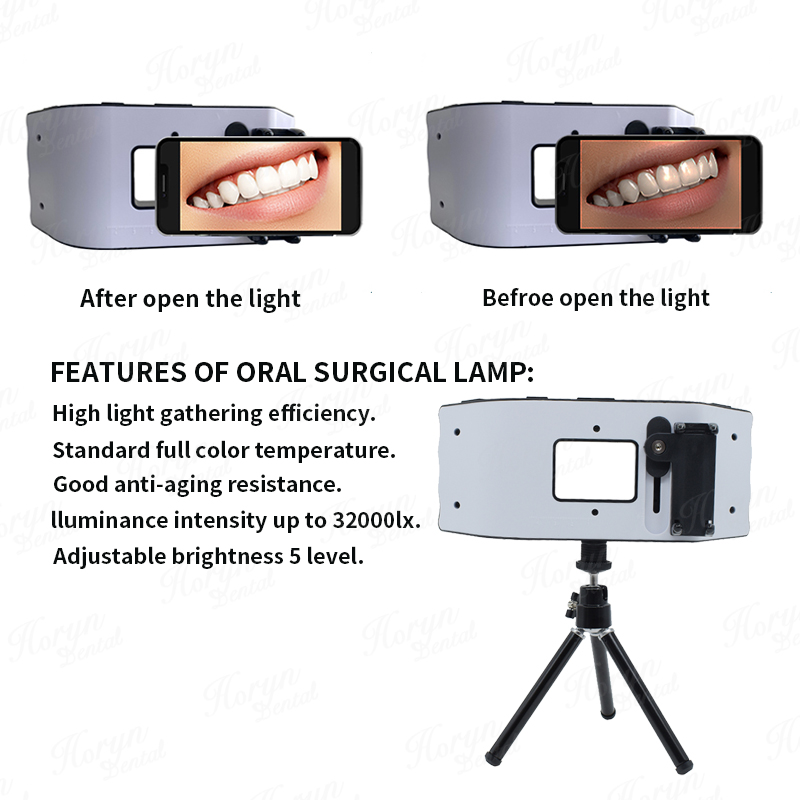 Dental Flash Light Photography - Photography Lighting Led review and price
